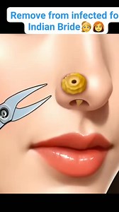 910K views · 2.6K reactions | Removing piercing from nose infected for Indian bride | #3danimation #animation #StarsEverywhere #health #treatment #followers #tranding #cleaning | Akhilesh Yadav | Facebook