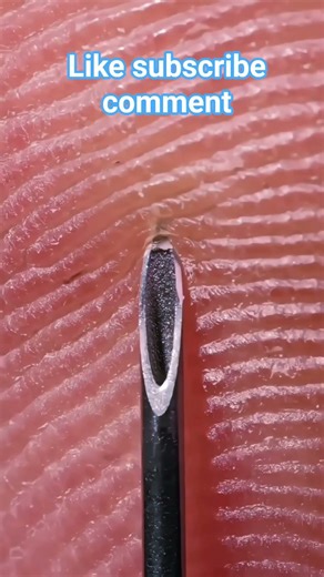 Needle inserting in finger zoom in microscope #microscope #shorts #shortvideo mymicrolab #gk #upsc