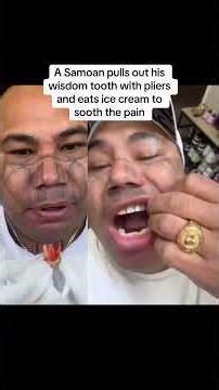 Samoan pulls out wisdom tooth with pliers 😮‍💨 #wisdomteethremoval #dentistry #shorts #viral #fyp