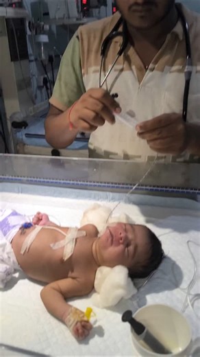 SUMIT NICU NURSING STM on Instagram: "Newborn baby being fed milk🍼👍 #youtubeshorts #nursing#newbornbaby #baby#cute#viralbabyl #instagram #nicunurse #trendingreels #newreels #viralreels #trending #reels #viralinstagramreelsvideo♥️ #gnm"