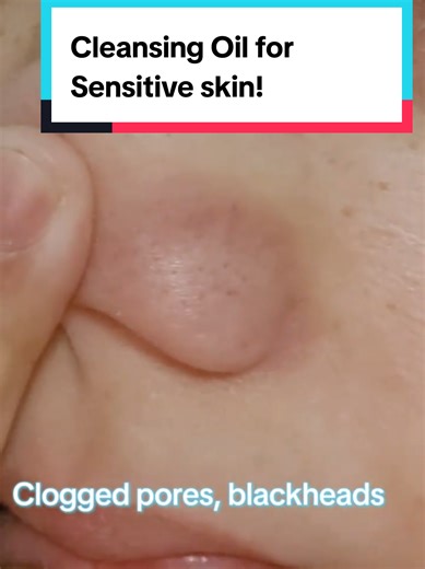 Sebum Extraction in real-time! #cleansingoil #doublecleansing #poredeepcleansingoil #PONGDANGcleansingoil @PONGDANG @4AM Marketing – Saebyeok Naesi