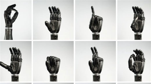 Watch: US firm’s bionic hand with 32 grip patterns brings sense of touch to prosthetics