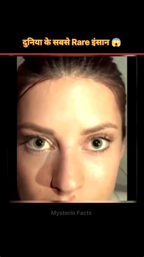 World's Most Rarest Humans 😱