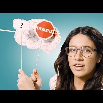 Forskare förklarar: Alzheimers sjukdom