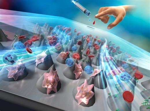 Detecting cancer cells in blood: Microfluidic device captures cancer cells with 90% efficiency