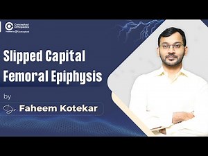 Slipped Capital Femoral Epiphysis by Dr.Faheem Kotekar