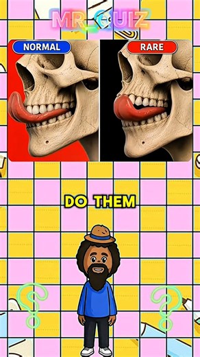 Can You Answer All 5 General Knowledge Questions Without Making a Single Mistake?