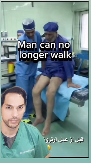 451K views · 619 reactions | Knee replacements are one of the most...