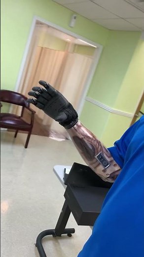 Below Elbow Myoelectric Arm With Electronic Terminal Device (Hook)