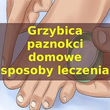 Grzybica paznokci – domowe sposoby leczenia
