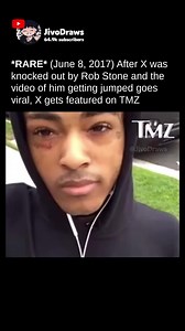 Rob stone so lame for what he did to X #xxxtentacion #xxxtentacionfight #xxxtentacionedits