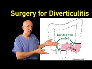 Surgery for diverticulitis: In-depth explanation