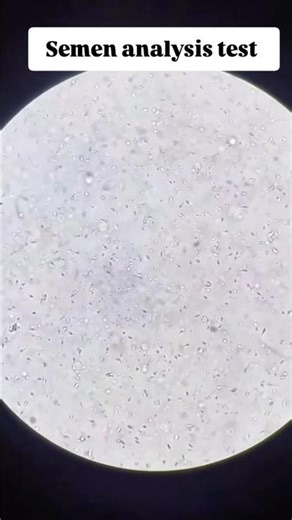 Part B… what is normal sperm count , motility and morphology #spermmorphology #spermselection #fyp