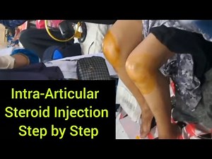 Intra-Articular Steroid Injection in Knee Joint | Step-by-Step Procedure & Technique