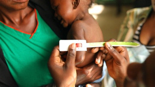 Malnutrition - hidden hunger worldwide