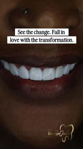 Smile Transformation Services in Miami