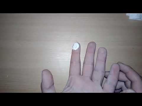 How to remove White-Out from skin in 60 seconds!