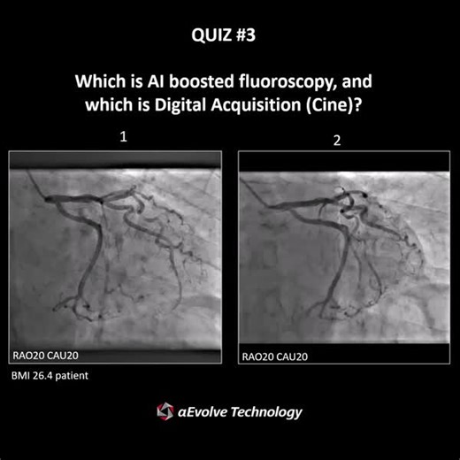 3.1K views · 14 reactions | Can you guess which is the fluoroscopy...
