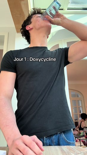 Préparation contre l'acné : Jour 1 avec Doxycycline