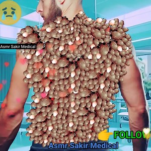 115K views · 781 reactions | ASMR treatment Maggot Infected Back | Dog Ticks Remove | Deep Cleaning Animation #Animation #Makeup #remove #Maggots #Treatment makeupanimation #asmrgaming #skincare #asmrtapping #asmrmake #Maggots #asmrsakirmedical | Asmr Sakir Medical | Facebook