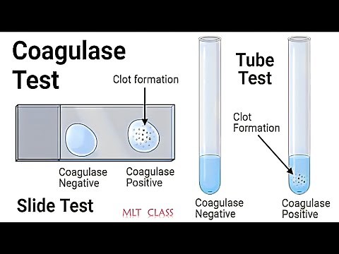 COAGULASE TEST PRACTICAL & THEORY VIDEO 💥🦠|| Coagulase Test for Staphylococcus aureus ‪@MLTclass‬ 🩸