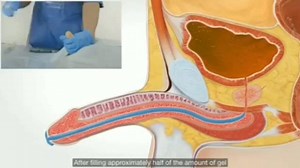 4.5K views · 132 reactions | Urinary catheterization | Nurses Note | Facebook