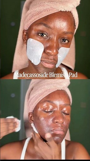 MEDIHEAL MADECASSOSIDE BLEMISH REPAIR | MEDIHEAL TRAIL | TAHJAERA #koreanskincare #mediheal #acne