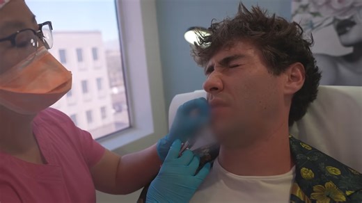 My lips are so numb - this man let a stranger inject his lips