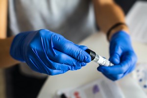 Il test salivare: l’«automonitoraggio» sicuro della pandemia in Ateneo