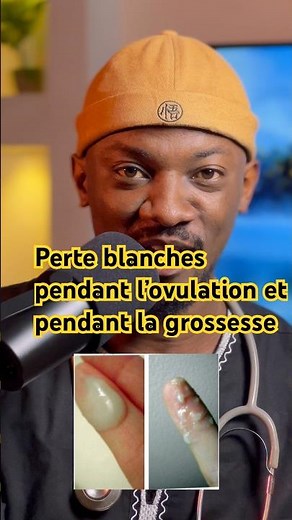 Les pertes blanches pendant l’ovulation et pendant la grossesse