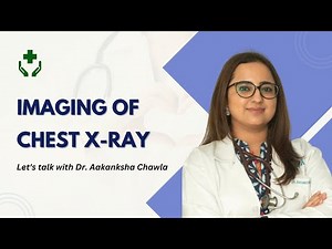 Imaging of Chest X-Ray | Explained by Dr. Aakanksha Chawla