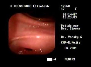 Endoscopia Digestiva Lizy