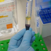 Vídeo: Um ensaio de citotoxicidade baseado em citometria de fluxo para a avaliação da atividade das células NK humanas