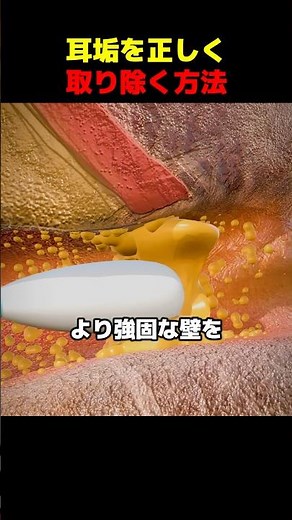 耳垢を正しく取り除く方法