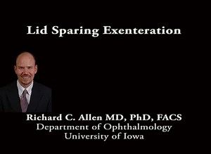 Lid sparing exenteration