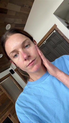 #masseterbotox #masseterinjection #tmj #tmjdisorder #migraine #botox #question