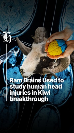 Ram Brains Used to study human head injuries in Kiwi breakthrough. Dr Helen Murray explains how new models could improve concussion science. | nzherald.co.nz