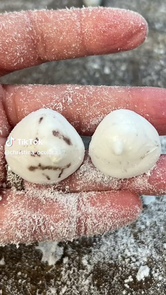 The Fascinating Story of a Man with Prosthetic Opal Eyes