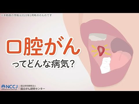 [Oral Cancer] What kind of disease is it? Daily self-checks can help you detect it early!