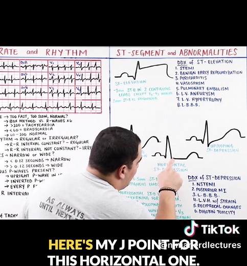 ST segment depression got you second-guessing every ECG? 👀🫀 Watch Zach break down ST Segment Depression the Ninja Nerd way. Clear, clinical, and actually makes sense. 🔥 If this clip helped, imagine the FULL lecture. Head to Ninja Nerd YouTube and watch: MASTER ECG / EKG INTERPRETATION High-yield. No fluff. Let’s master ECGs together.