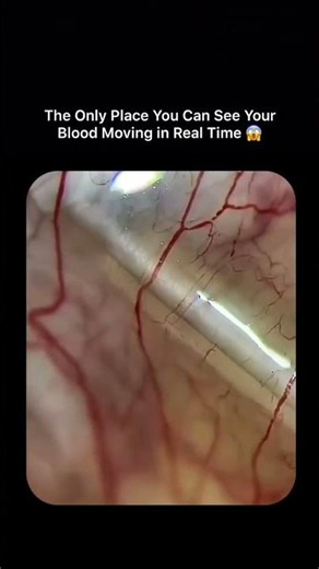 Real-Time Blood Flow in the Human Eye | Sclera Blood Vessels Explained 🔬