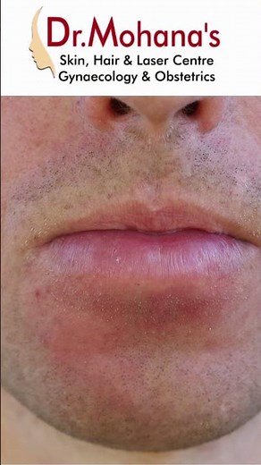 Skin Allergy. Causes Symtoms and Treatments