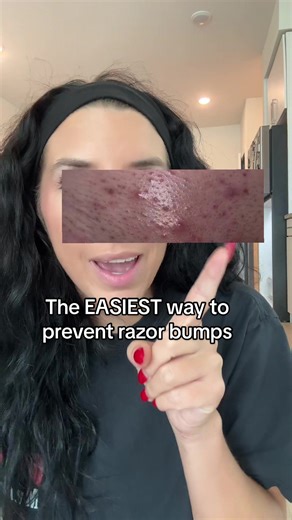 Game Changer: Prevent Razor Bumps Effectively