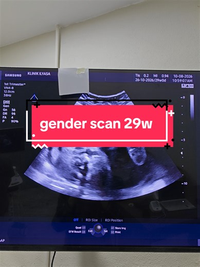 Gender Scan 29 Weeks: What to Expect at a 29w Pregnancy Scan