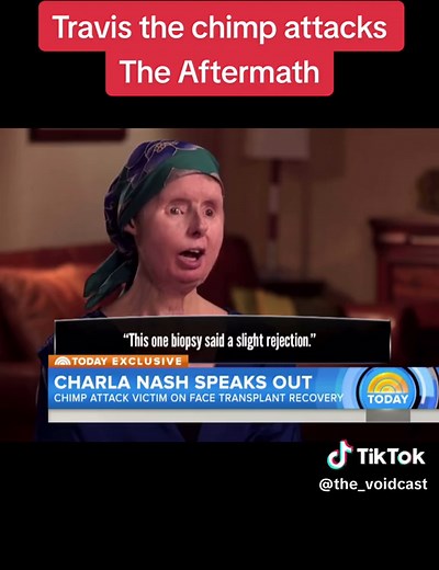 The #travisthechimp story #survivor and progress!! #911calls #fyp | travis the chimp phone call