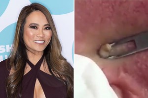 Dr Pimple Popper removes blackhead from man’s ear - joking ‘he’s lost weight’