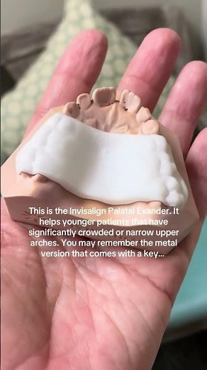 Invisalign palatal expander #orthodontics #invisalign