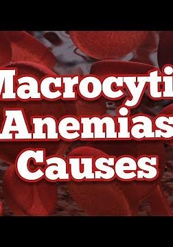 Causes of Macrocytic Anemias | Mnemonic