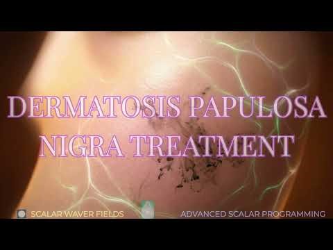 Dermatosis Papulosa Nigra Treatment (Amplified Energetic In-Formation)