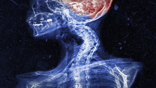 I'll just crack it myself – hours later, her brain was starving of blood